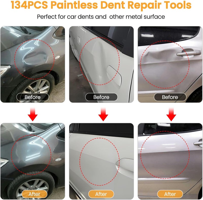 Sigoobal Dent Puller, 134PCS Paintless Dent Removal Kit – Car Dent Puller Kit with Slide Hammer 2 in 1 T-Bar, Golden Lifter, Bridge Puller–Dent Remover Tool for Car Hail, Dings Damage DIY Repair - Image 2